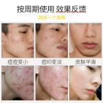 Powerful Herbal Acne Cream to Fade Acne Marks and Pits, Repair Acne, Remove Acne, and Remove Acne Cream, Genuine Wholesale